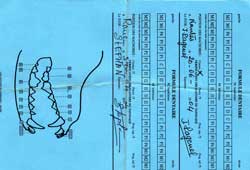 Carte dentaire complète